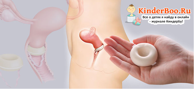 Контрацепция во время грудного вскармливания - ВИРИЛИС - детские медицинские программы